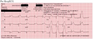 STEMI Ambulance Service of Manchester Pre-hospital EKG Transmission