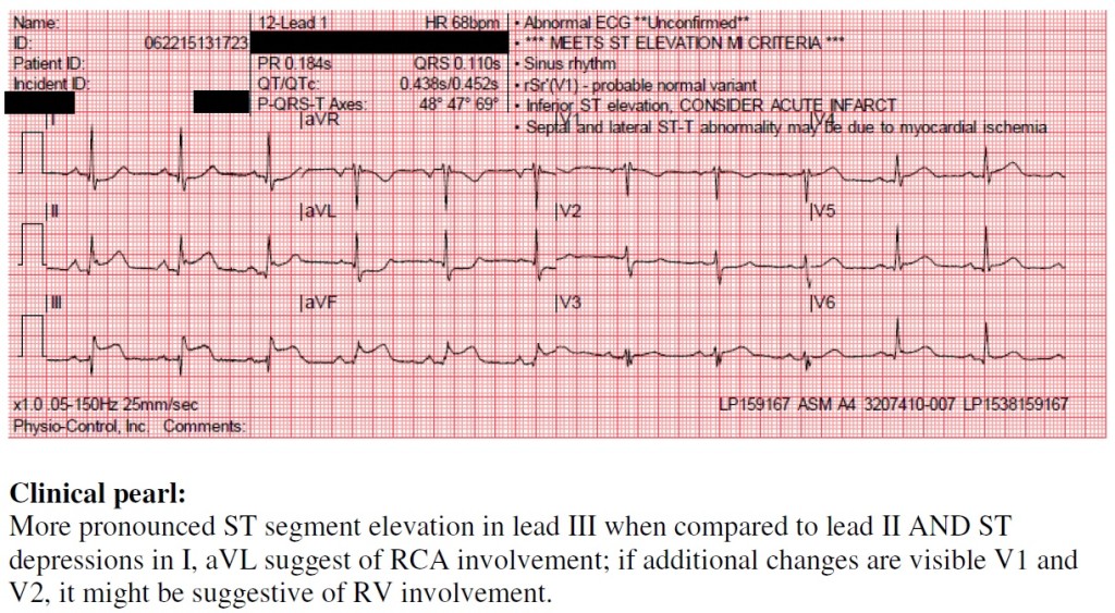 Kudos from the Cath Lab Volume 14 ASMAETNA Blog
